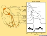 Cardiopathies : Les troubles du rythme cardiaque